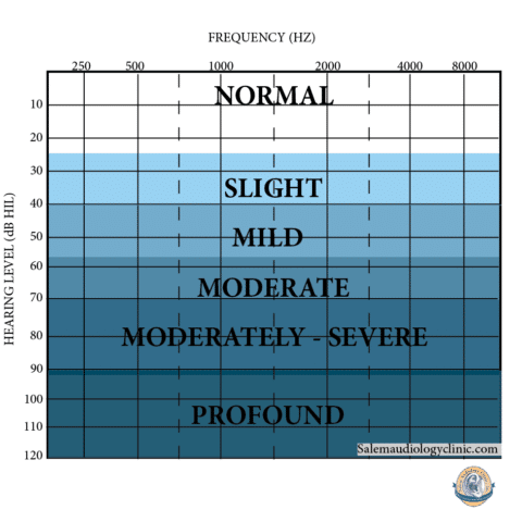 Decibels And Hearing Loss Salem Audiology