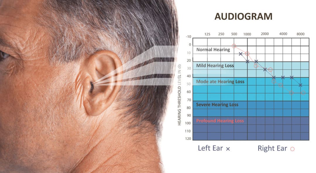 Hidden Hearing Loss Salem Audiology Community