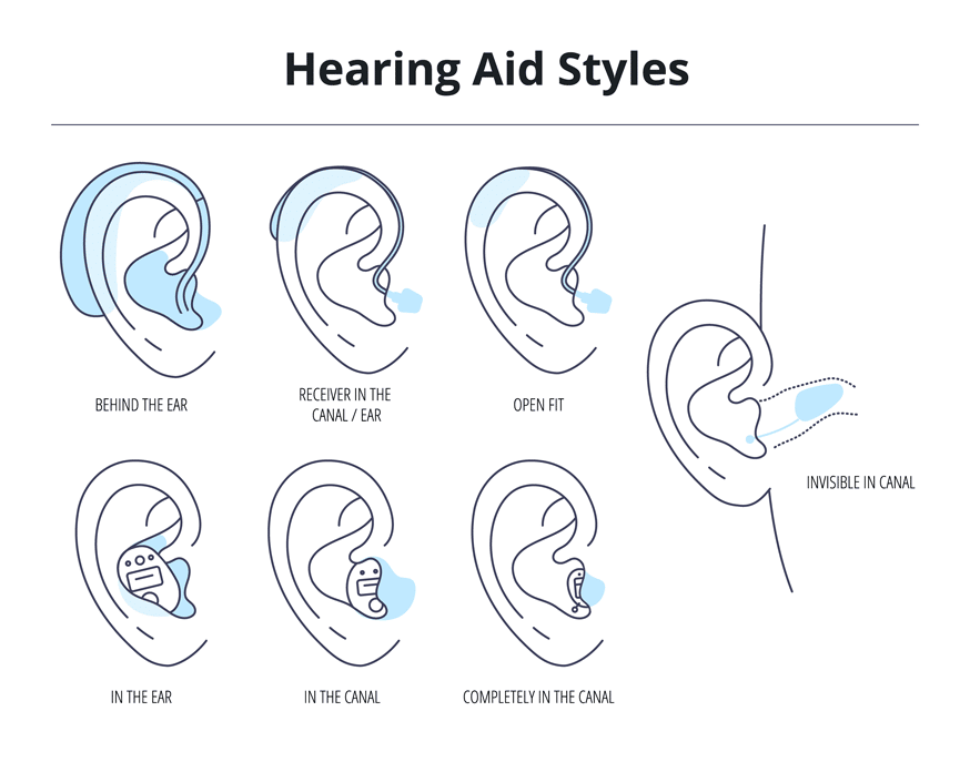 Different styles of hearing aids chart