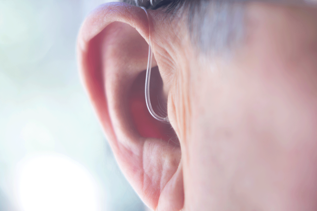Hearing-aids Hearing Aids